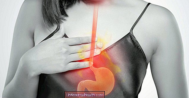 Bolesť v krku a reflux kyseliny: Aký je odkaz? - kyslý reflux - gerd