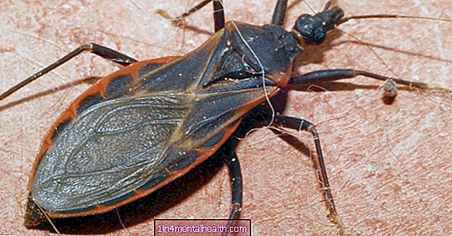 Kissing bug bites: Symptom, risker och behandlingar