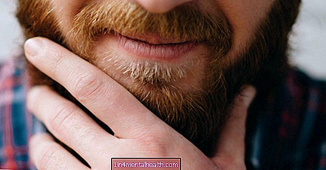 allergia - Millised on mõned habeme sügelevad ravimid?