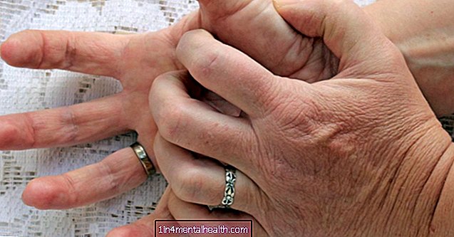 Što uzrokuje svrbež prstiju? - alergija