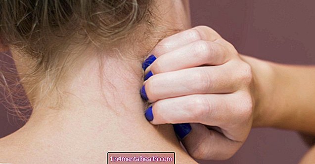 Wat te doen bij een jeukende nek - allergie