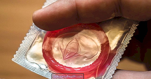 Какво да знаете за презервативите и алергиите - алергия