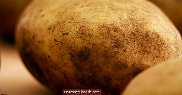Was Sie über Kartoffelallergien wissen sollten - Allergie