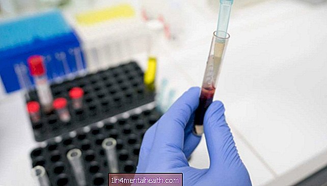अल्जाइमर रक्त परीक्षण लगभग 'नियमित नैदानिक ​​देखभाल में प्रयोग करने योग्य' - अल्जाइमर - मनोभ्रंश