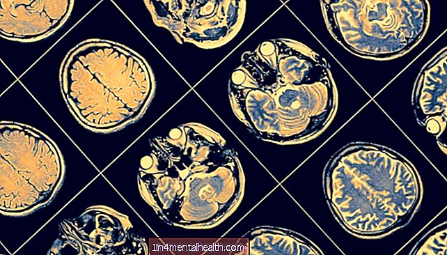 Alzheimerova choroba: Průkopnický plán si klade za cíl zaměřit se na základní příčinu