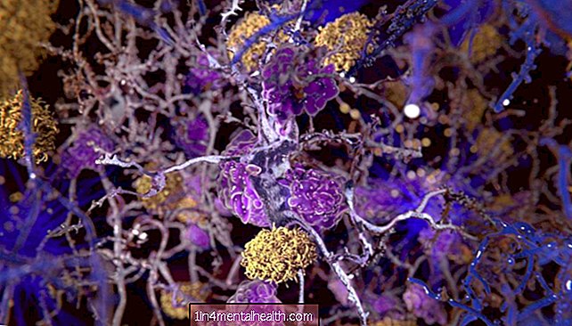 Alzheimerjeva bolezen: kako tau moti možganske celice? - alzheimers - demenca
