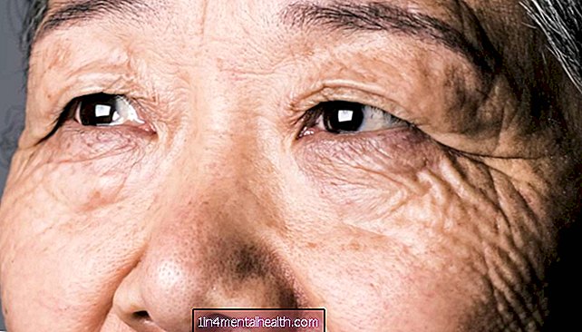 Тестовете за проследяване на очите могат да предскажат риска от Алцхаймер - алцхаймер - деменция