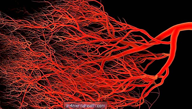 Los vasos sanguíneos con fugas pueden desencadenar la enfermedad de Alzheimer