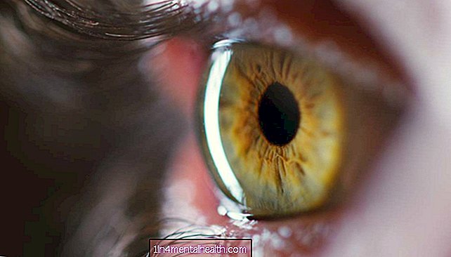 Изображенията на ретината показват обещание за ранно откриване на болестта на Алцхаймер - алцхаймер - деменция