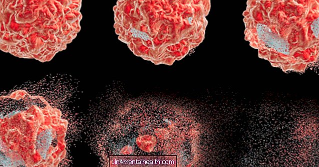 biologi - biokemi - Cancercellernas överlevnadsstrategi besegrade med en ny strategi