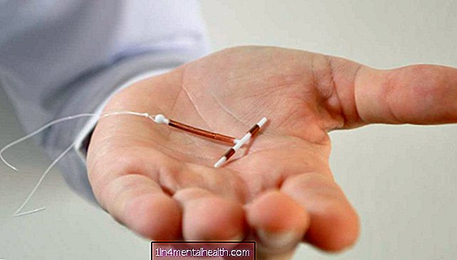 Può uno IUD causare sanguinamento dopo il sesso? - controllo delle nascite - contraccezione