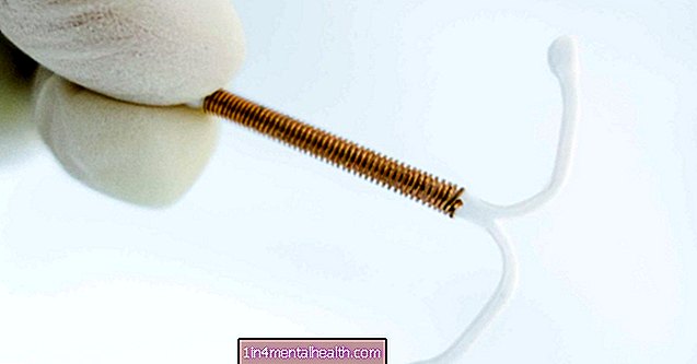 Kaj pričakovati med vstavljanjem IUD - kontracepcija - kontracepcija