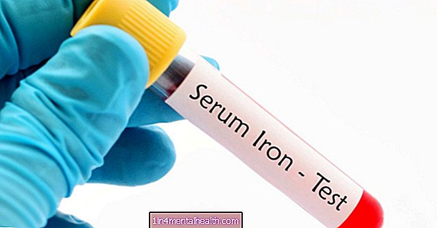 Ujian besi serum: Julat tinggi, rendah, dan normal - darah - hematologi