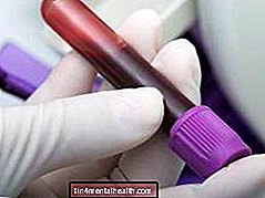 ¿Qué son los niveles de BUN y qué miden? - sangre - hematología
