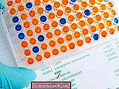 Који су Вестерн блот и ЕЛИСА тестови за ХИВ? - крв - хематологија
