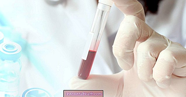 Vad betyder onormala ALP-nivåer? - blod - hematologi
