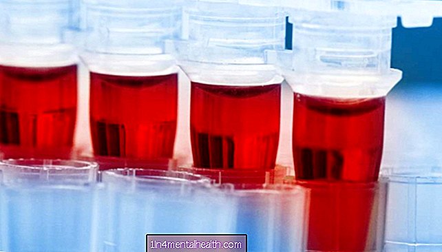 Vad säger ett serumalbumintest dig? - blod - hematologi