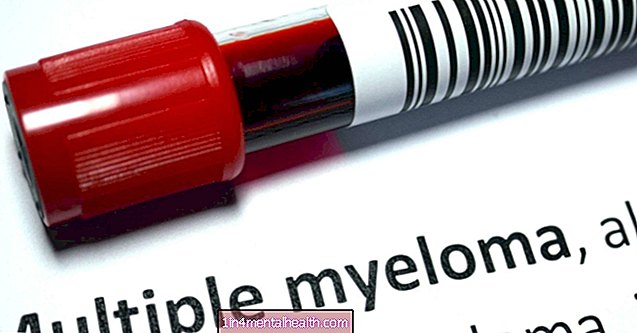 kraujas - hematologija - Koks yra pirmasis išsėtinės mielomos požymis?
