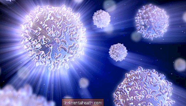 Kaj vedeti o visokem številu belih krvnih celic - kri - hematologija