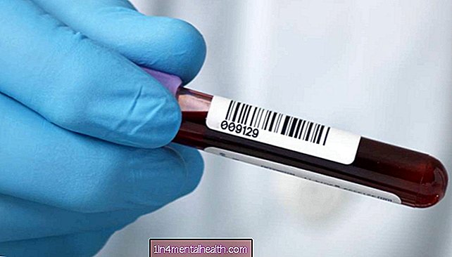sangre - hematología - Lo que debe saber sobre la prueba de anticuerpos contra el músculo liso