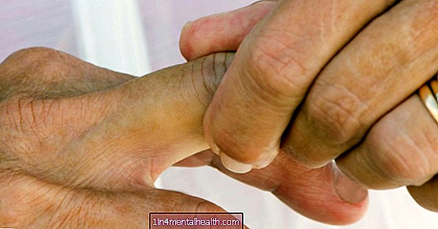 Pirkstu raustīšanās cēloņi un ārstēšana