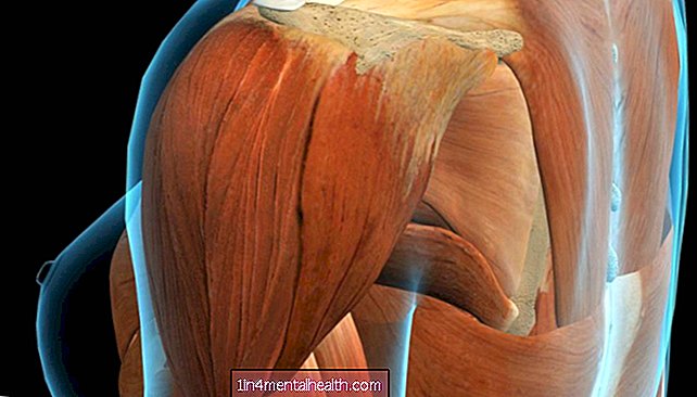 Bolesť deltového svalu: Typy a liečba - bolesti tela
