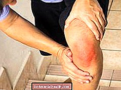 Gliederschmerzen - Warum tun mir die Knie weh, wenn ich Treppen steige?