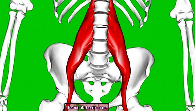 Kõik, mida peate teadma puusaliigese painutaja koormuse kohta - luud - ortopeedia