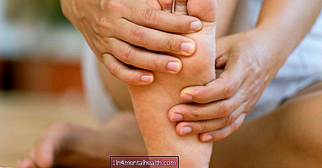 Příčiny a léčba bolesti v klenbě nohy - kosti - ortopedie