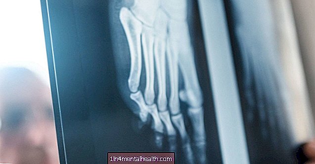 Fußknochen: Alles was Sie wissen müssen - Knochen - Orthopädie