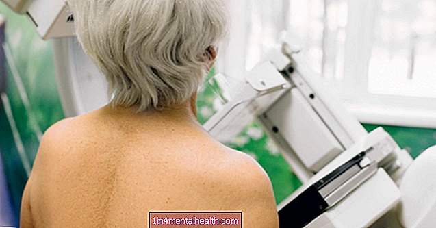 Juhend mammograafi ettevalmistamiseks - rinnavähk
