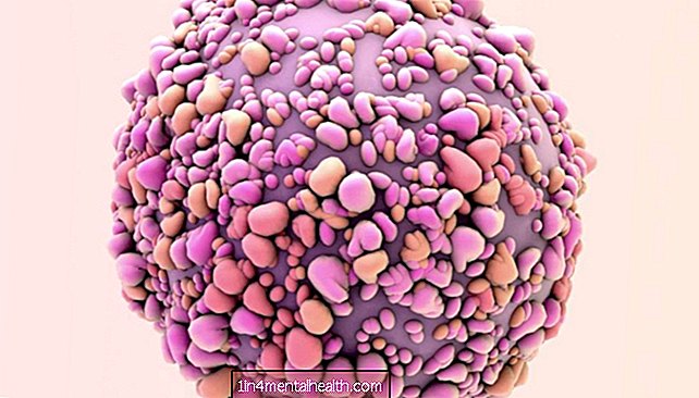 Antibiotikas var novērst krūts vēža atkārtošanos - krūts vēzis