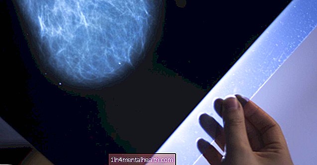 Bröstcancer: Hur snabbt sprider den sig?
