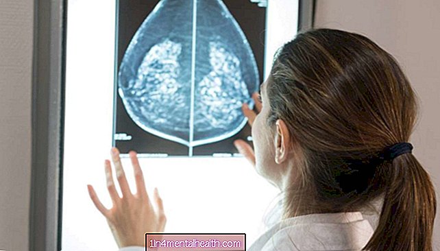 Рак груди: белок инь-ян отвечает за рост опухоли