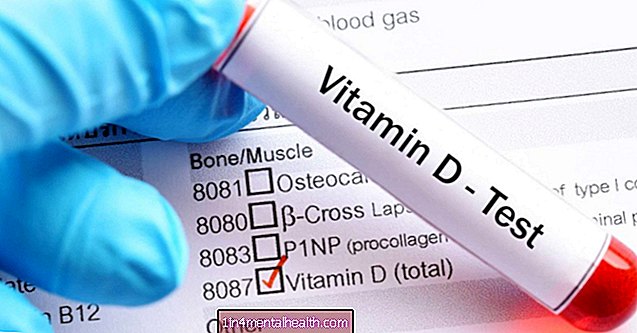 Ali nizke ravni vitamina D povečajo tveganje za nastanek raka dojke?