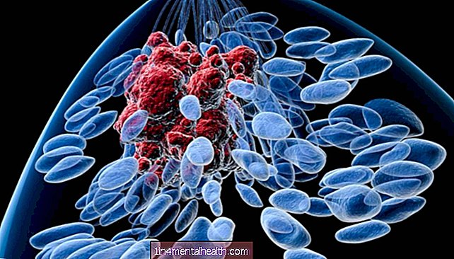 Jak buňky aktivně zastavují invazivitu rakoviny prsu