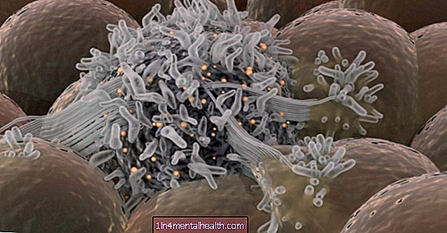 meme kanseri - Bu protein üçlü negatif meme kanserini besler