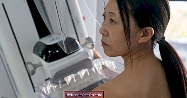 एक स्टीरियोटैक्टिक स्तन बायोप्सी में क्या शामिल होता है? - स्तन कैंसर