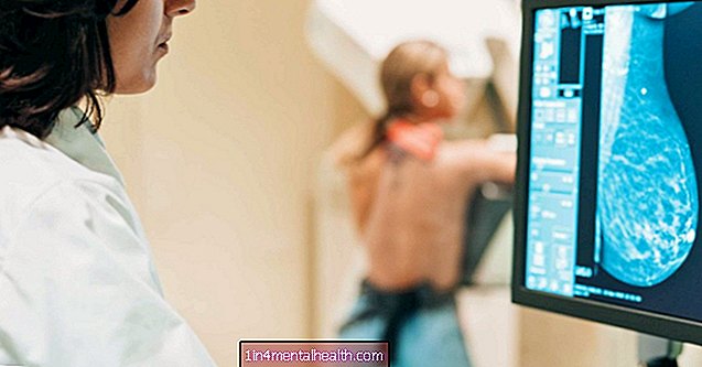 Шта знати о 3Д мамографима - карцином дојке