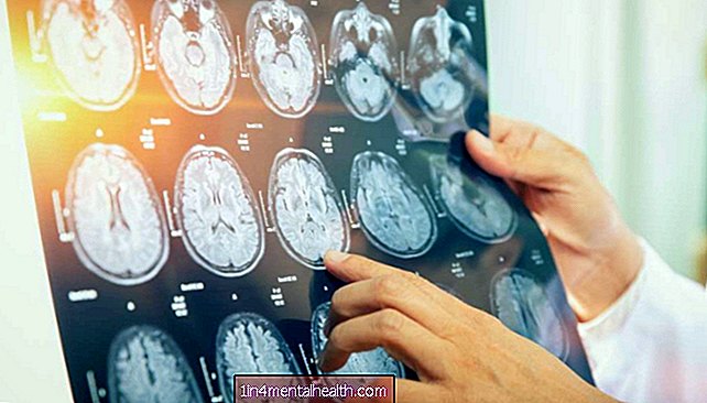 Kanser otak: Lithium dapat memulihkan fungsi kognitif selepas radiasi - barah - onkologi