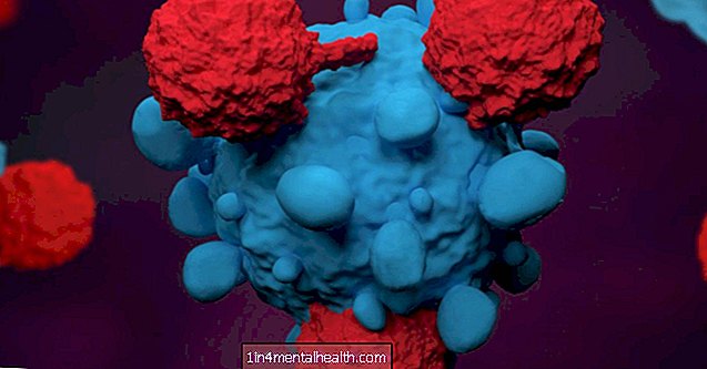 Krebs und Fettleibigkeit: Verstopfte Immunzellen erklären den Zusammenhang