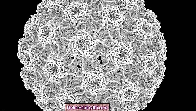 Bagaimana virus dapat melindungi dari kanker kulit - kanker - onkologi