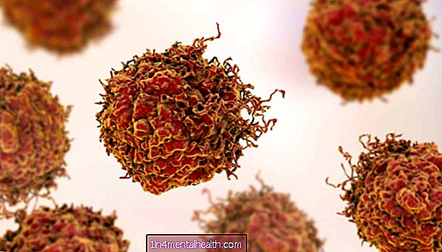 'Insektisida alami' membunuh sel kanker prostat yang sudah lanjut