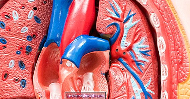 Ką reikia žinoti apie aortos skrodimą - širdies ir kraujagyslių - kardiologija