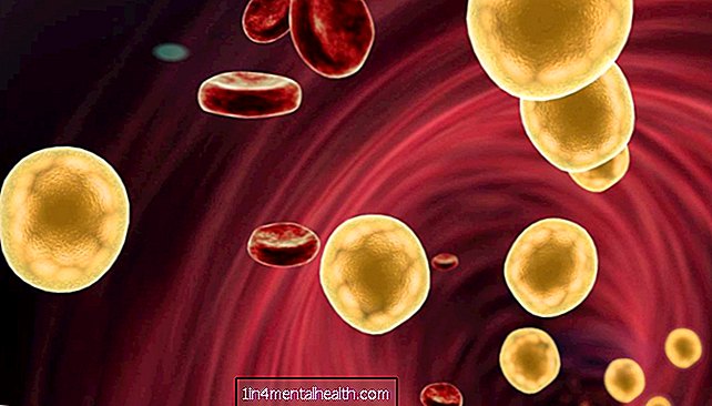 Dyslipidémia: Všetko, čo potrebujete vedieť - cholesterolu