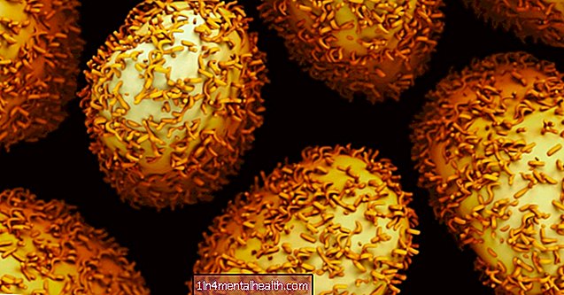 Rakovina tlustého střeva a konečníku: Některé buňky se „rodí jako špatné“