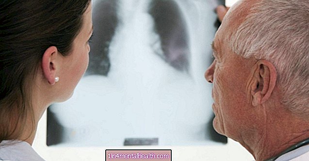Apakah COPD muncul di X-ray?