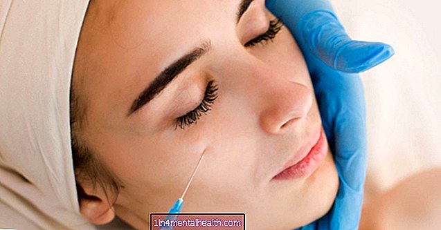 Voitteko käyttää Botoxia silmiesi alla? - kosmeettinen lääketiede - plastiikkakirurgia