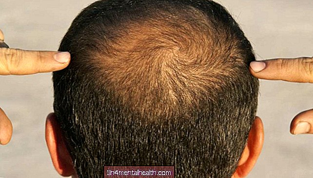 Выпадение волос: ученые тестируют носимое устройство для отрастания волос - косметическая медицина - пластическая хирургия