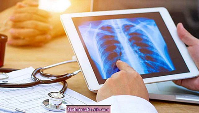 Fibrosis kistik: Obat yang ada dapat meningkatkan fungsi paru-paru - fibrosis kistik